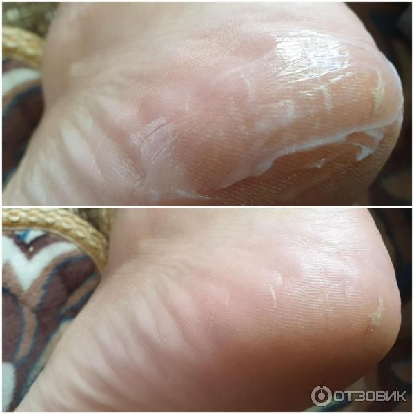 Крем для ног Avon Foot Works Intensive Callus Cream От мозолей и натоптышей фото