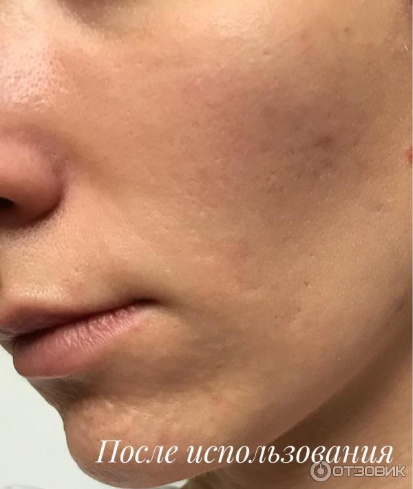 Сыворотка с антиоксидантами Aravia Professional Antioxidant-Serum фото