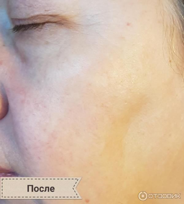 Сыворотка с антиоксидантами Aravia Professional Antioxidant-Serum фото