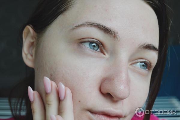 Микроотшелушивающий очищающий гель La Roche-Posay Effaclar фото