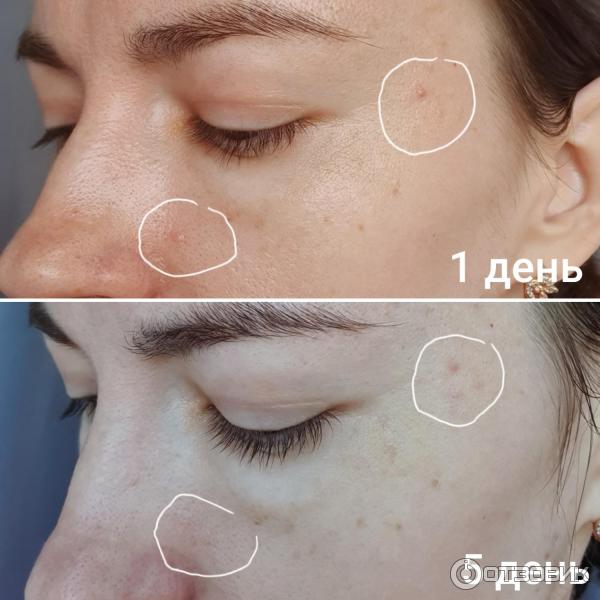 Микроотшелушивающий очищающий гель La Roche-Posay Effaclar фото