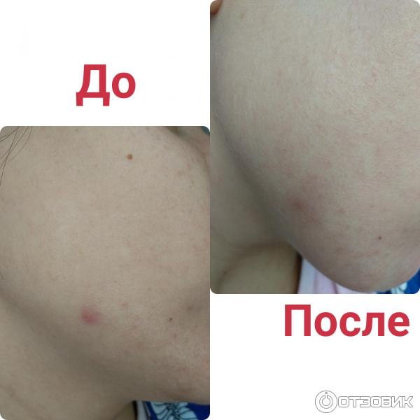 Микроотшелушивающий очищающий гель La Roche-Posay Effaclar фото