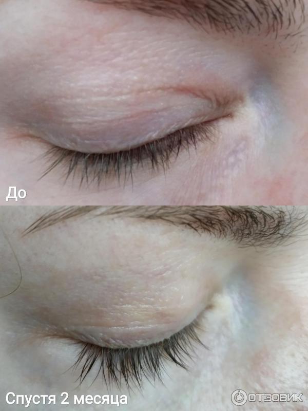 Сыворотка для роста бровей и ресниц TopLash Lash and Brow Booster фото