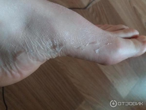 Отшелушивающая маска-носочки для ног Vilenta Shiny Foot фото