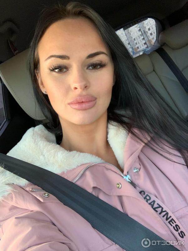 Дарья блохина губы до и после