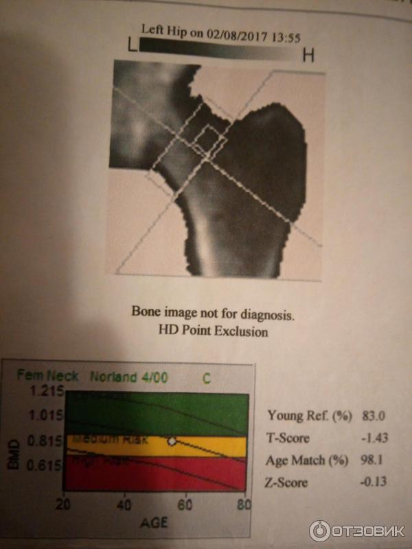Денситометрия костей фото