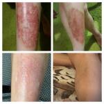 Мазь для наружного применения от псориаза Qicun baxian фото